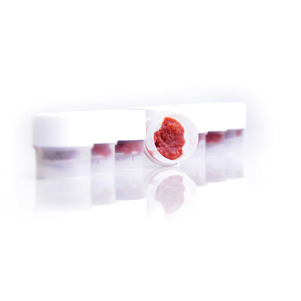 02 16 0655a wvi3 pfo cryoeliso